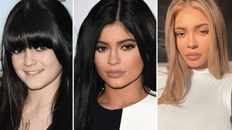 BBLs, lip filling, and what-have-you. The appropriation of black features continues to spin billions of dollars while black women are simultaneously stuffed in the bottom of every pyramid society can construct.